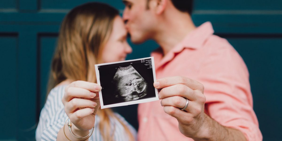man kissing woman's forehead white holding ultrasound photo